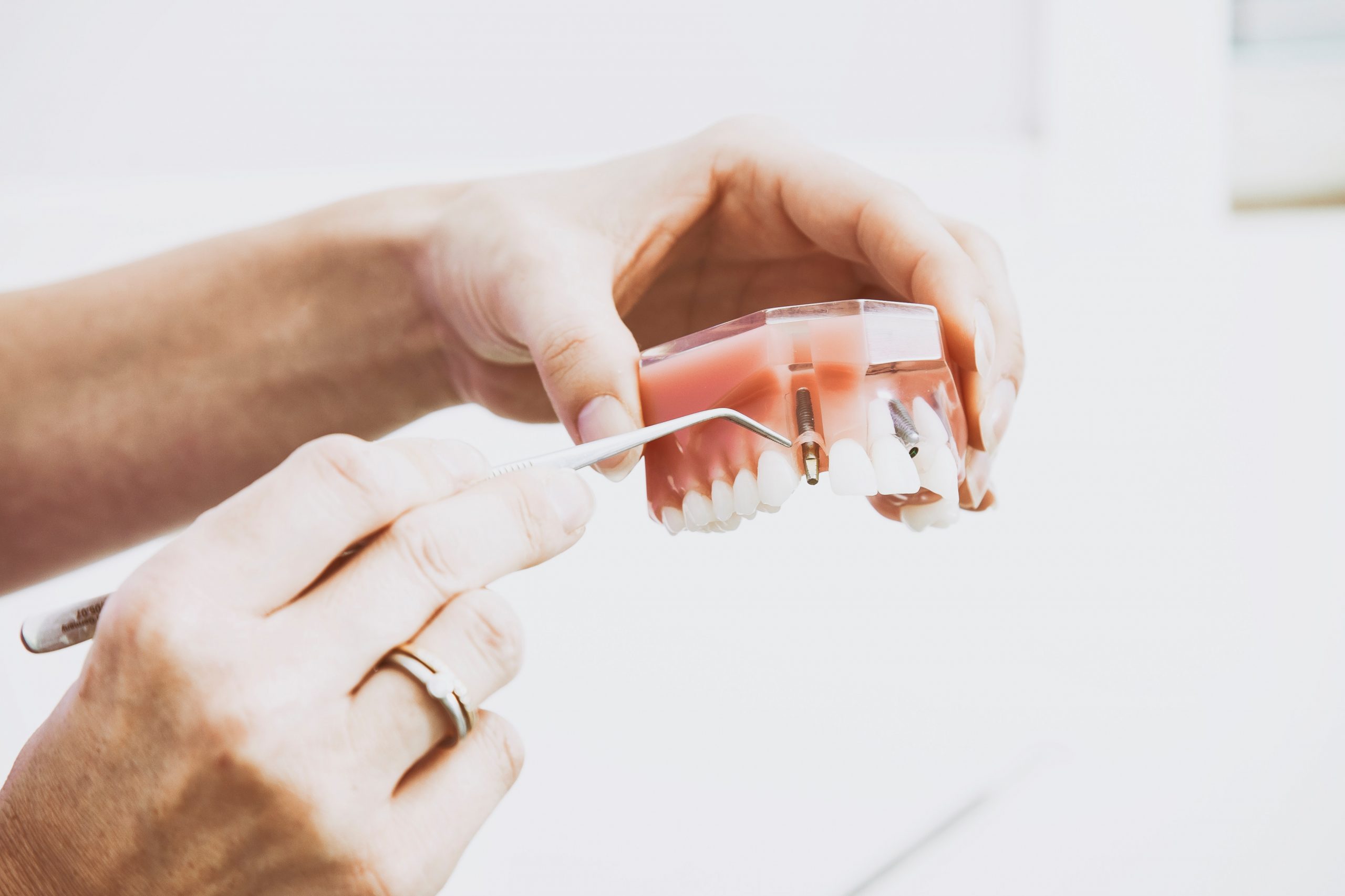 Efficacité d’une approche thérapeutique axée sur les traumatismes pour la phobie des dents