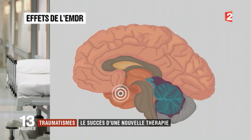 le succès de l'EMDR, cette nouvelle thérapie qui soigne les traumatismes