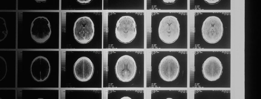 Scanner d'un cerveau
